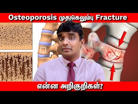 வயதானவர்களுக்கு முதுகு வலி, நடப்பதில் கடினம் காரணம் என்ன? | Dr Vijayaraghavan