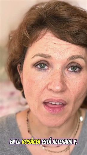 Your ROSACEA needs THIS.