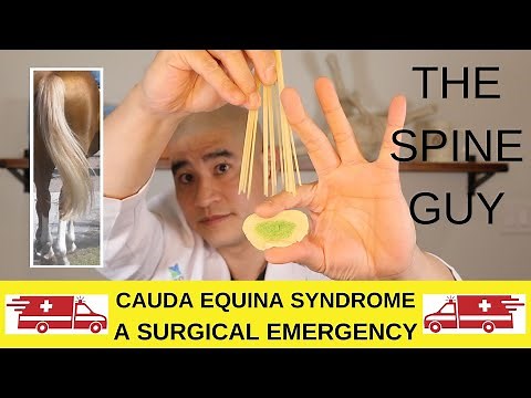 Cauda Equina Syndrome: A Surgical Emergency