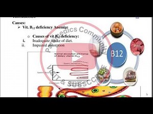 What is Megaloblastic Anemia? its Causes, Symptoms and treatment? | Physiology. #anemia #physiology