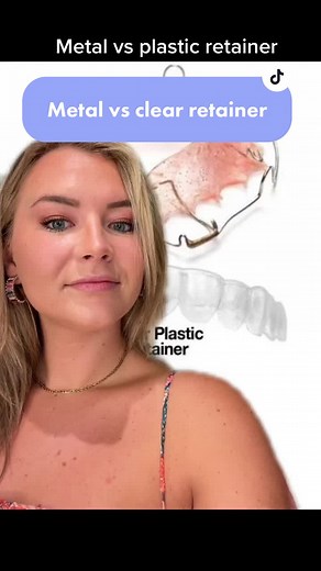 Clear vs. Metal Retainers: Which Is Best?