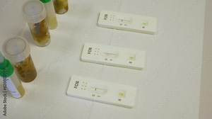 Feces samples from human stool on rapid test cassette using chromatography and immunochemistry in small laboratory in medical clinic