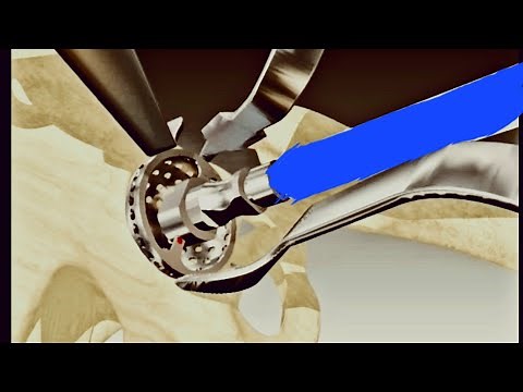 Practical Tips for Acetabular preparation in THA