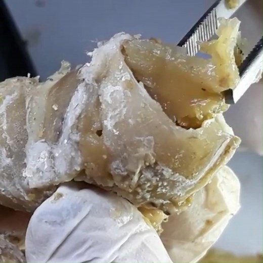 429The Inside Of The Toenail Is Deteriorating, Be Careful To Separate It | Digital Technology