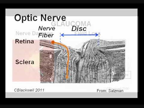 Eye Works 2: Image: Retina, Optic Nerve and Brain