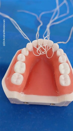 Lower Arch Retainer Demonstration