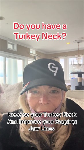 Reverse Turkey Neck and Achieve V Line Perfection