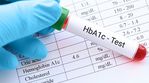 What Is an A1C Test?