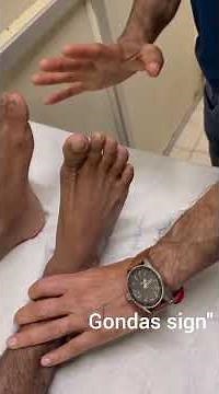 Methods Of Elicitation of Extensor Plantar Response