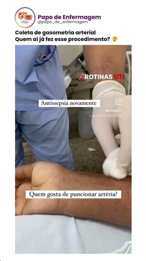 Coleta de gasometria arterial