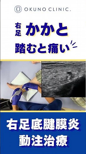 そのかかとの痛み、放置しないで