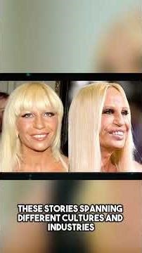 20 Celebrities With the Most Controversial Plastic Surgery Transformations 10