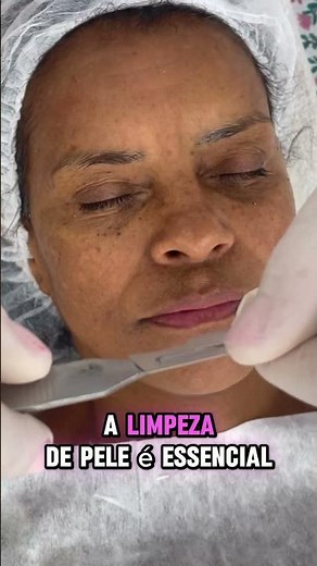 Learn how to prepare your face with skin cleansing! #skincleansing #plasmajet #facialesthetics