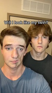 My first plastic surgery is on November 23rd! 😁 #plasticsurgery #tiktokforgood #303 | Lukas Caldwell