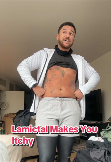 Understanding Lamictal Side Effects: Rashes and Itchiness