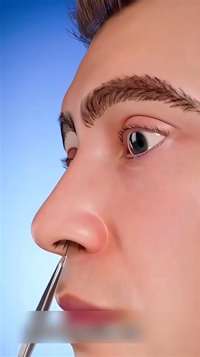 Naak ke baal aise mat ukhadiye! #healthfacts