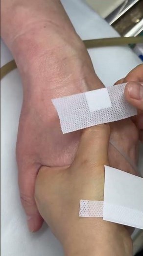 Intramuscular Injection Technique Explained | Safe IM Injection Step-by-Step | Nurse Guide Class 32
