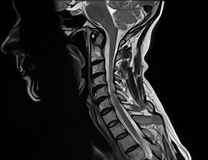 IRM Colonne cervicale - IRM des Sources