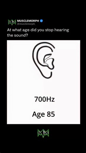 👇 Drop your hearing test score in the comments, and tag someone who still thinks yelling “WHAT?” across the house is normal. Most people over 40 think their hearing is “fine”… until they take this test. High-frequency hearing loss is the first sign your body is aging faster than you think, and it’s not just about your ears. It’s your brain. 🧠 Research shows hearing loss is directly linked to faster brain shrinkage, lower cognition, increased loneliness, and even early death. Why does it happen