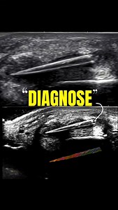 Focus on heel swelling 😲😲😔 #ultrasound #ultrasonography #radiology #sonography | Ultrasound report expert
