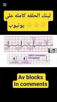 difference between av block degrees 👌♥️