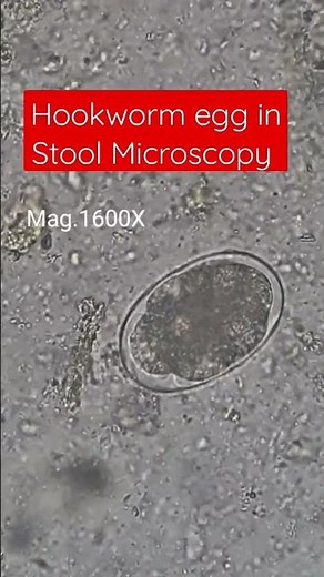 Hookworm egg in Stool Microscopy at a magnification of 1600X