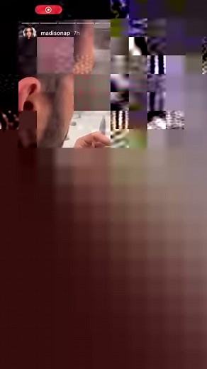 34K views · 531 reactions | She hated her buck teeth…it’s incredible what a new smile can do. Talk about a weight immediately lifted and the light finally shines in their eyes. And these are just the temps… | Smile Again Dental - Texas | Facebook