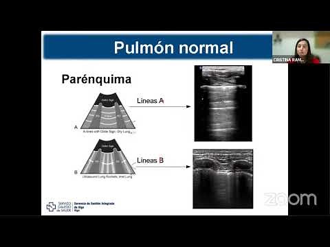 Introducción a la ecografía torácica. Cristina Ramos.