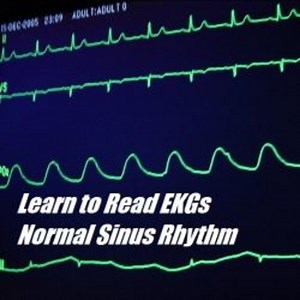 How to Read EKGs – Normal Sinus Rhythm