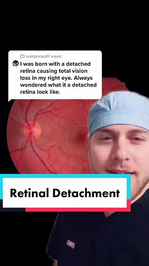 Understanding Retinal Detachment Symptoms and Treatment