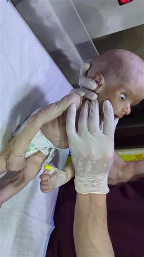 Captivating Moments: A Newborn's First Breath