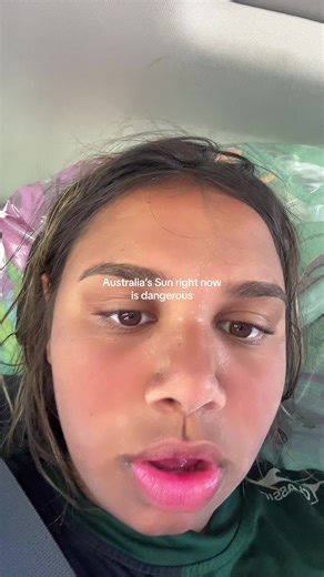 Australia's Dangerous Sun: Protect Yourself from Sunburn