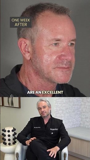 The Male Neck Lift: Masculine by Design | Feldmar Plastic Surgery
