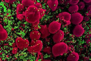 Experimental peptide targets Covid-19