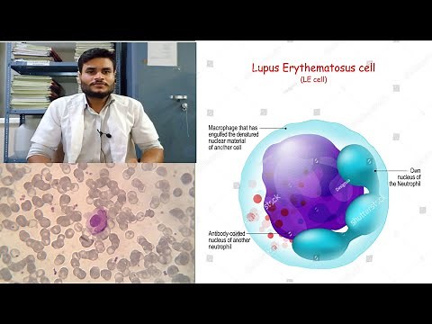 LE cell |LE cell phenomenon| LE cell preparation | lupus erthrometous