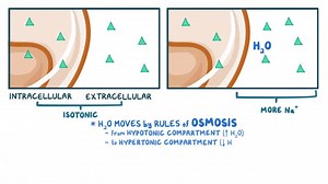 Video: Hyponatremia: Clinical - Video Explanation! | Osmosis | Osmosis
