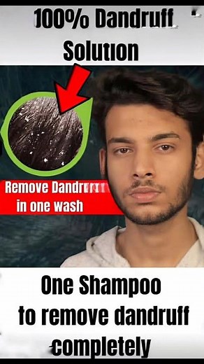 One shampoo to remove dandruff | #dandruffsolution