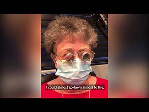 Patient with macular degeneration receives full diameter telescope glasses