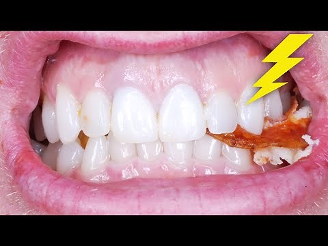 WHY DOES MY TOOTH HURT WHEN I BITE DOWN, CHEW, & EAT? Dentist Explains Every Biting Toothache Pain