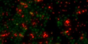 Learning More About Changes in Cancer Cell Identity | Genetics And Genomics