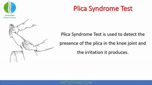 Plica Syndrome Test Explained Easily | OrthoFixar