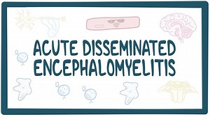 Acute disseminated encephalomyelitis: Video, Causes, & Meaning | Osmosis