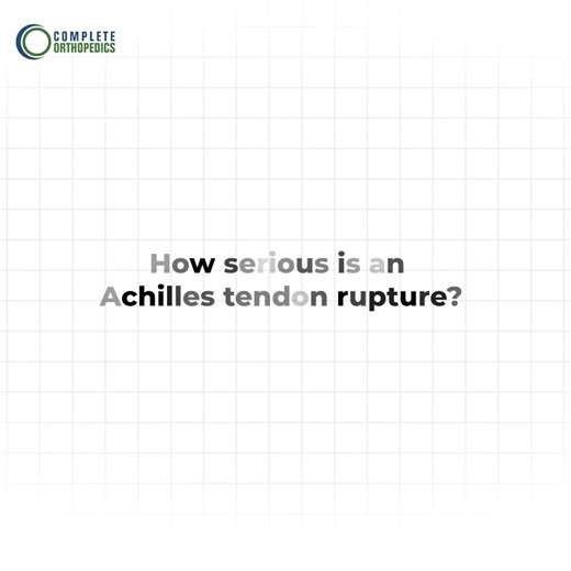 How serious is an achilles tendon rupture?