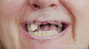 Close-up Toothless Mouth of an Woman. Stock Video - Video of black, care: 184461303