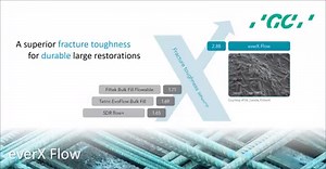 5.8K views · 65 reactions | Discover everX Flow, a short-fibre reinforced flowable composite designed to replace dentine and reinforce restorations. Following the same principle as the iron rebar in construction, the glass fibres in everX Flow strengthen restorations and prevent them from cracking. | GC Europe | Facebook