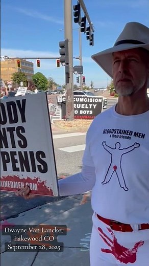 infant circumcision is exactly what it appears to be - a deliberate injury to the penis of the man