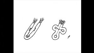 The X-Pulley Technique for Subpectoral Long Head of the Biceps Tenodesis Using All-Suture Anchors