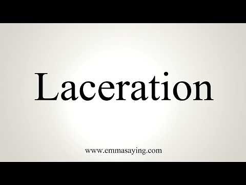 How To Pronounce Laceration