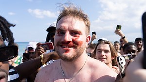 Spring Break revelers reveal bloody faces and drone footage shows beach carnage
