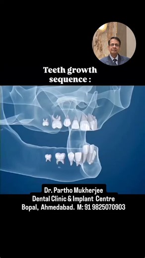 Tooth development progresses through several stages, beginning with initiation and continuing through proliferation, morphodifferentiation, apposition, and finally eruption. The initial stages are the bud, cap, and bell stages, characterized by the changing shape of the tooth germ. Following these, the apposition stage involves the deposition of enamel and dentin, and the root develops. The final stage, eruption, is when the tooth emerges into the mouth. Dr. Partho Mukherjee Dental Clinic & Impl